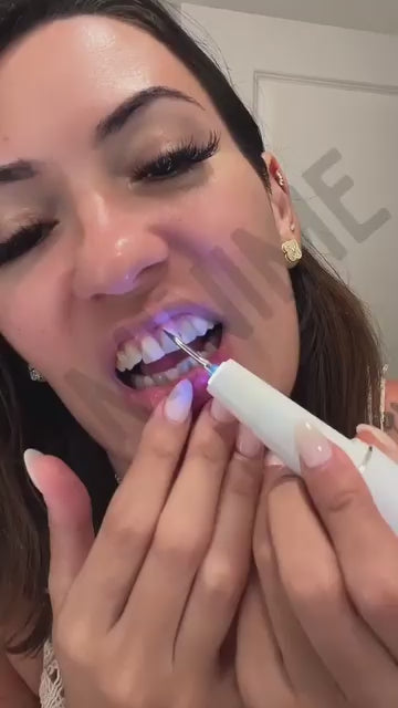 Removedor de Sarro Dental